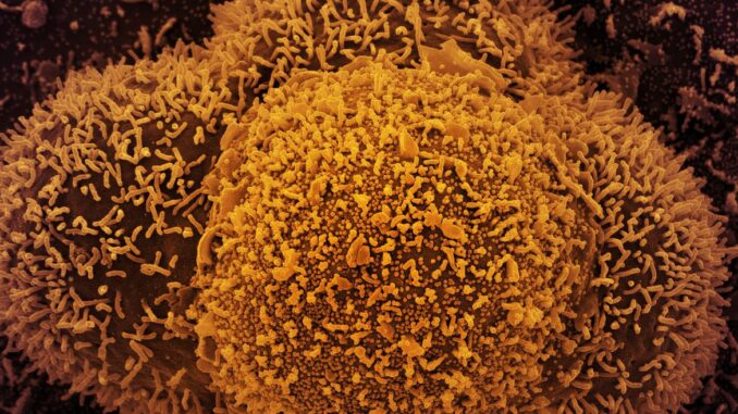 Dois casos foram detectados no Rio de Janeiro e em Santa Catarina.